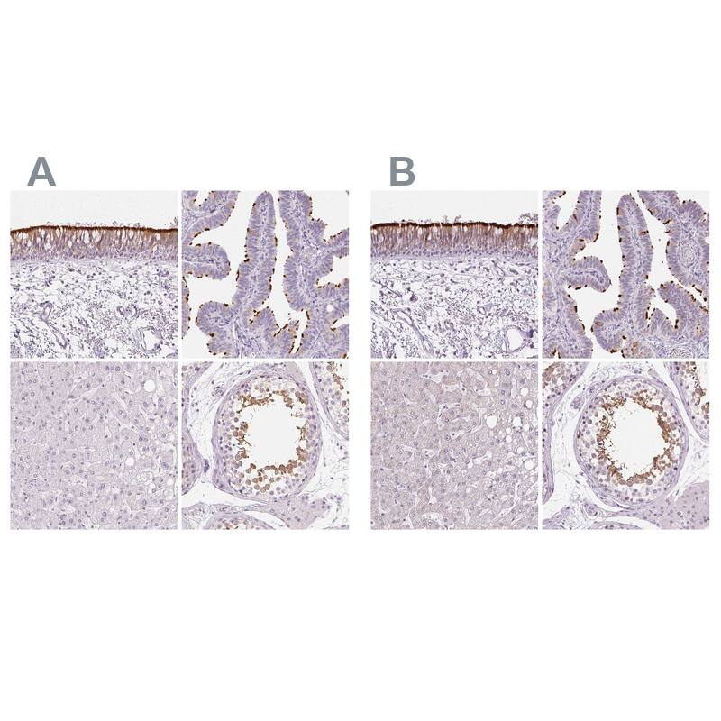 Ropporin 1-like Antibody - BSA Free Immunohistochemistry: Ropporin 1-like Antibody - BSA Free [NBP1-90081]