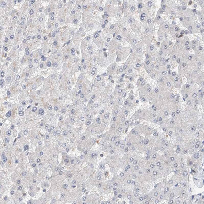 ASCC3L1 Antibody - BSA Free Immunohistochemistry: ASCC3L1 Antibody - BSA Free [NBP1-90086]
