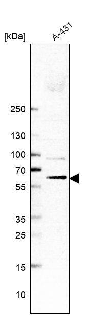 Membralin Antibody - BSA Free Western Blot: Membralin Antibody - BSA Free [NBP1-90088]