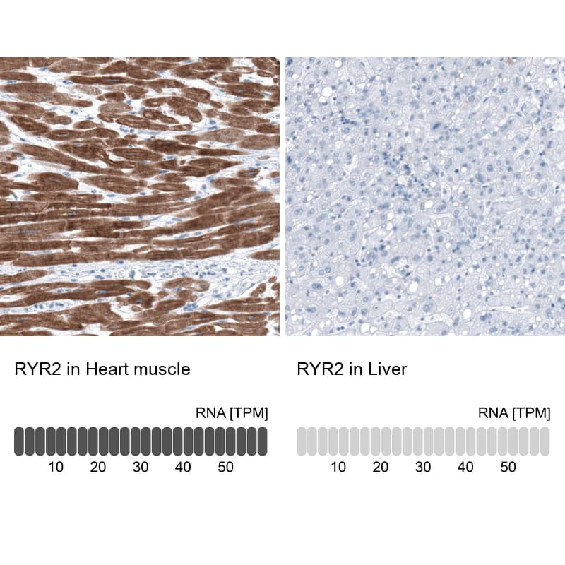 Ryanodine Receptor 2 Antibody - BSA Free Immunohistochemistry: Ryanodine Receptor 2 Antibody - BSA Free [NBP1-90091]