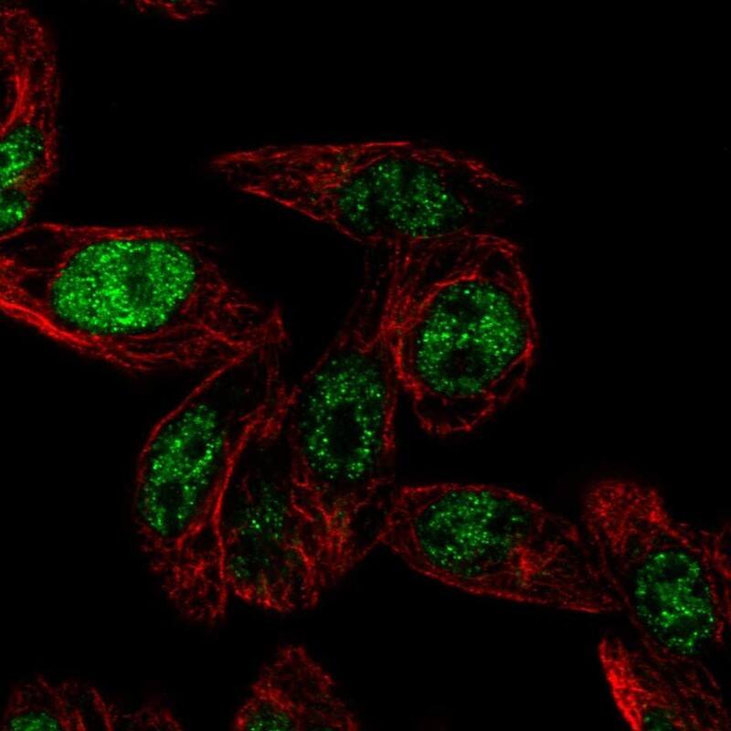 Septin-4 Antibody - BSA Free Immunocytochemistry/ Immunofluorescence: Septin-4 Antibody [NBP1-90093]