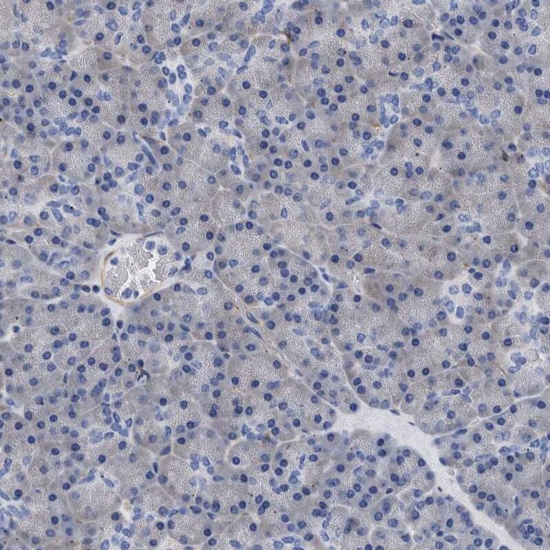 Septin-4 Antibody - BSA Free Immunohistochemistry: Septin-4 Antibody - BSA Free [NBP1-90094]