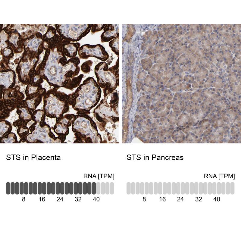 Steroid sulfatase Antibody - BSA Free Immunohistochemistry-Paraffin: Steroid sulfatase Antibody - BSA Free [NBP1-90095]