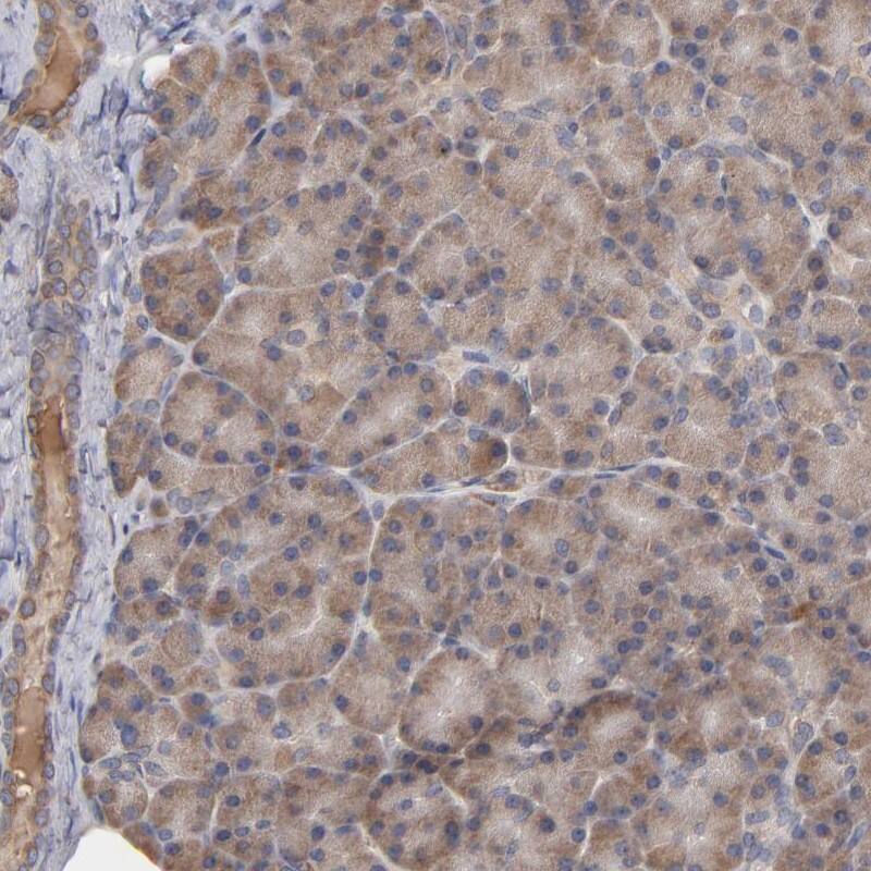 Steroid sulfatase Antibody - BSA Free Immunohistochemistry-Paraffin: Steroid sulfatase Antibody - BSA Free [NBP1-90095]