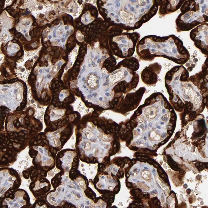 Steroid sulfatase Antibody - BSA Free Immunohistochemistry-Paraffin: Steroid sulfatase Antibody - BSA Free [NBP1-90095]