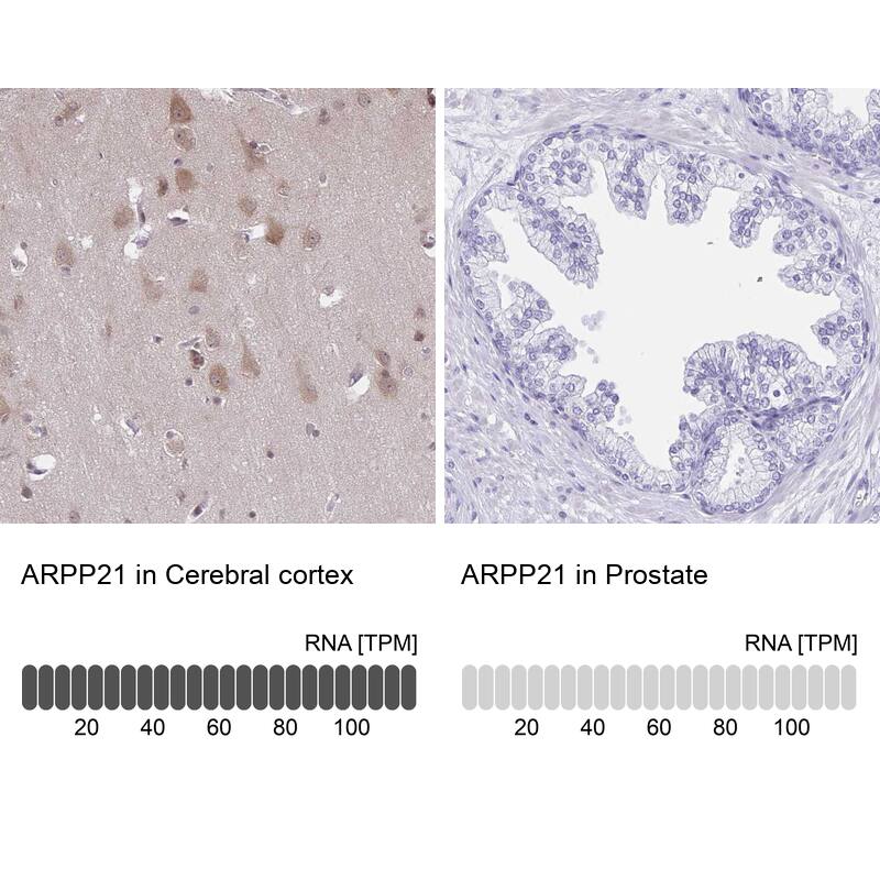ARPP-21 Antibody - BSA Free Immunohistochemistry: ARPP-21 Antibody - BSA Free [NBP1-90096]