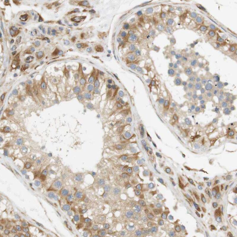Cytohesin 3 Antibody - BSA Free Immunohistochemistry: Cytohesin 3 Antibody - BSA Free [NBP1-90097]