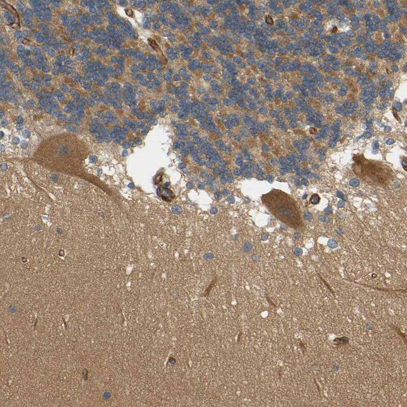 Cytohesin 3 Antibody - BSA Free Immunohistochemistry: Cytohesin 3 Antibody - BSA Free [NBP1-90097]