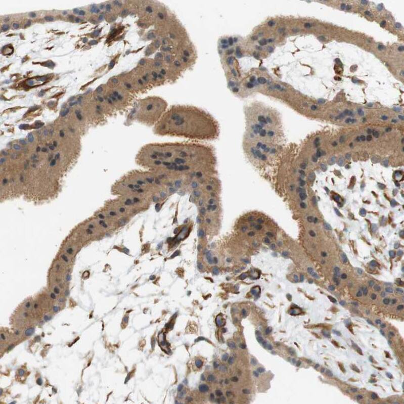 Cytohesin 3 Antibody - BSA Free Immunohistochemistry: Cytohesin 3 Antibody - BSA Free [NBP1-90097]