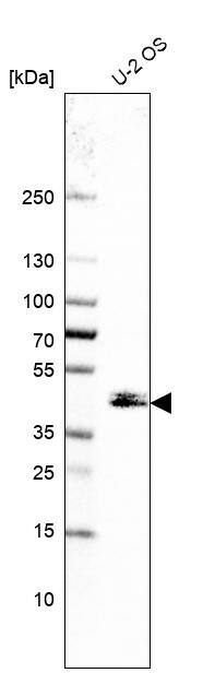 Cytohesin 3 Antibody - BSA Free Western Blot: Cytohesin 3 Antibody - BSA Free [NBP1-90097]