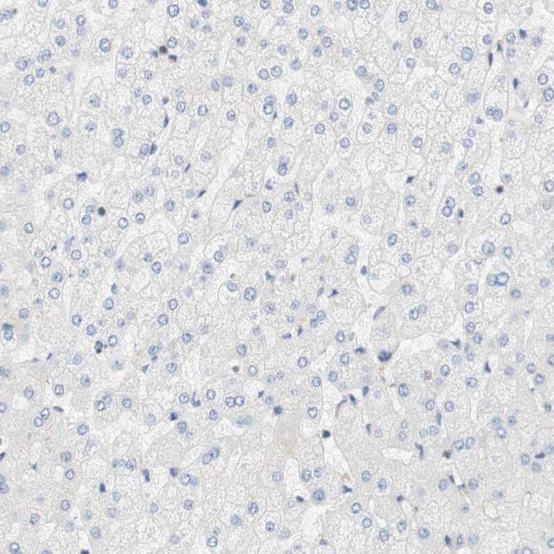 Cytohesin 3 Antibody - BSA Free Immunohistochemistry: Cytohesin 3 Antibody - BSA Free [NBP1-90097]