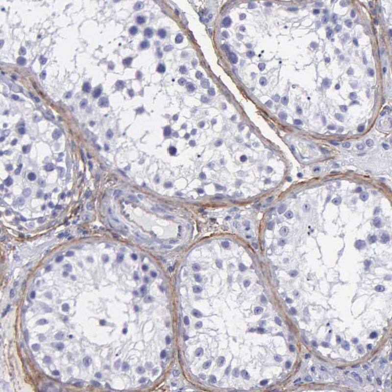 Fibulin 5/DANCE Antibody - BSA Free Immunohistochemistry: Fibulin 5/DANCE Antibody - BSA Free [NBP1-90100]