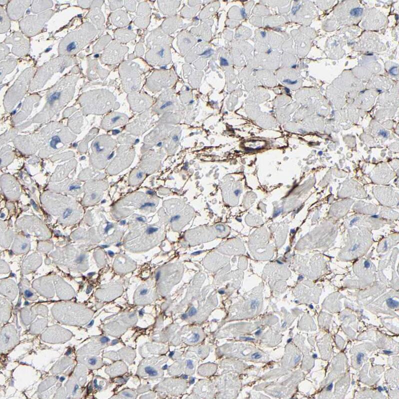 Fibulin 5/DANCE Antibody - BSA Free Immunohistochemistry: Fibulin 5/DANCE Antibody - BSA Free [NBP1-90101]