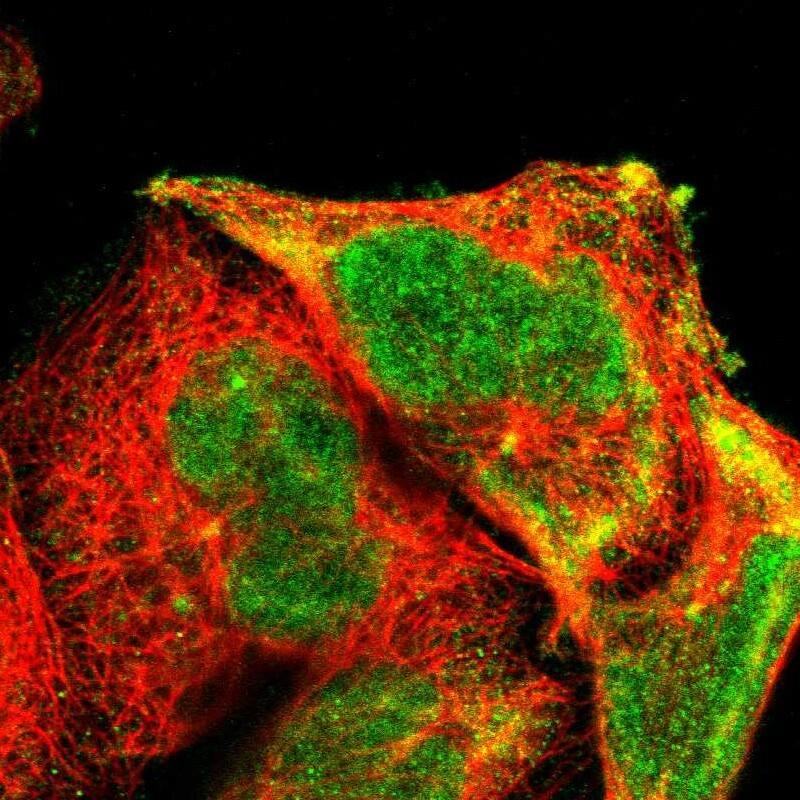 Aurora A Antibody - BSA Free Immunocytochemistry/ Immunofluorescence: Aurora A Antibody [NBP1-90103]