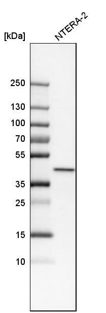 NIPP1 Antibody - BSA Free Western Blot: NIPP1 Antibody - BSA Free [NBP1-90111]