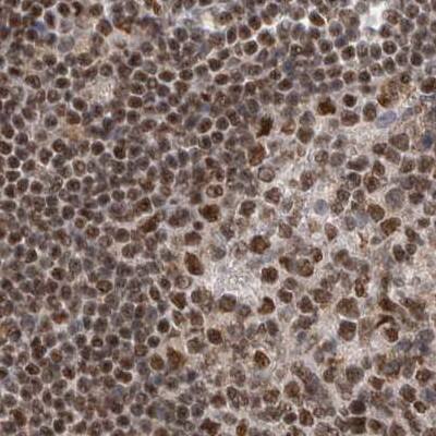 NIPP1 Antibody - BSA Free Immunohistochemistry-Paraffin: NIPP1 Antibody [NBP1-90112]