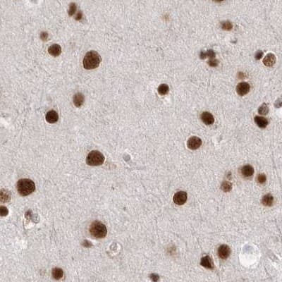 NIPP1 Antibody - BSA Free Immunohistochemistry-Paraffin: NIPP1 Antibody [NBP1-90112]
