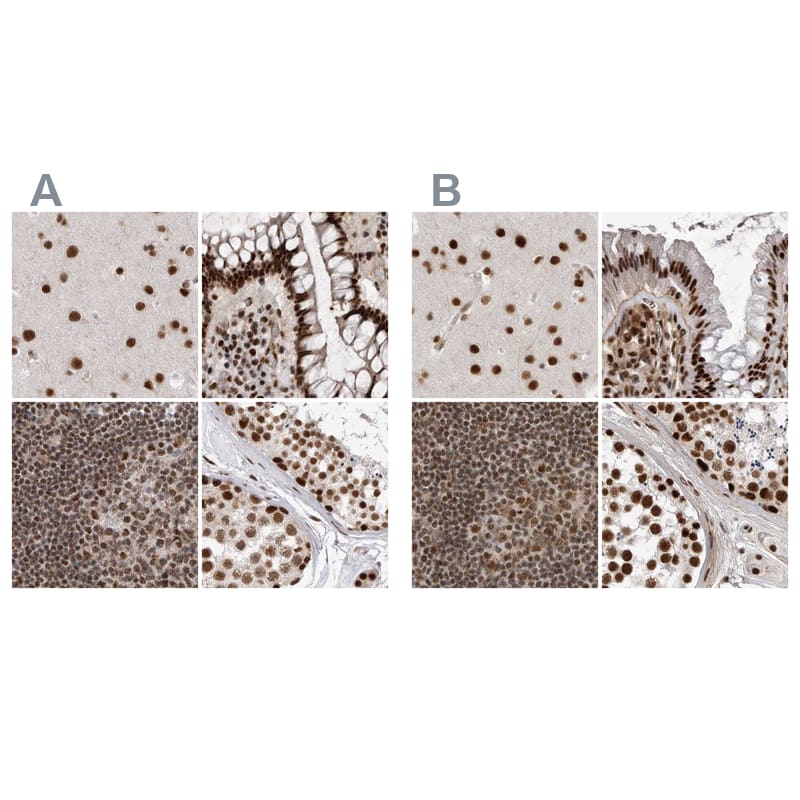 NIPP1 Antibody - BSA Free Immunohistochemistry-Paraffin: NIPP1 Antibody [NBP1-90112]