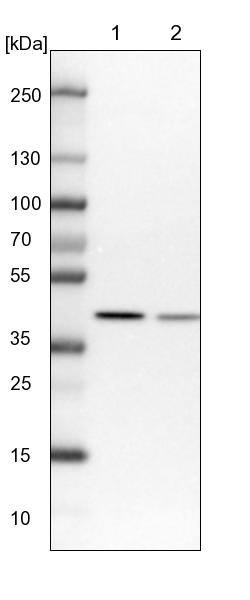 NIPP1 Antibody - BSA Free Western Blot: NIPP1 Antibody - BSA Free [NBP1-90112]