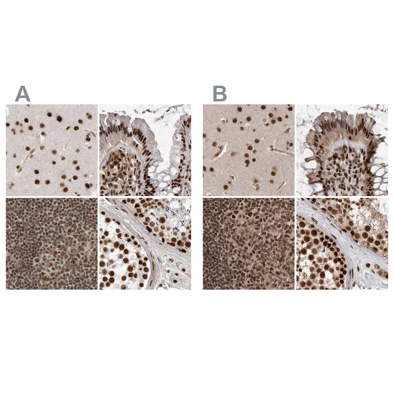 NIPP1 Antibody - BSA Free Immunohistochemistry: NIPP1 Antibody - BSA Free [NBP1-90113]