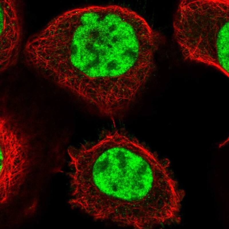 NIPP1 Antibody - BSA Free Immunocytochemistry/ Immunofluorescence: NIPP1 Antibody - BSA Free [NBP1-90113]