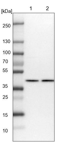 NIPP1 Antibody - BSA Free Western Blot: NIPP1 Antibody - BSA Free [NBP1-90113]