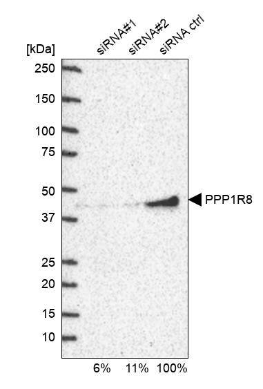 NIPP1 Antibody - BSA Free Western Blot: NIPP1 Antibody - BSA Free [NBP1-90113]
