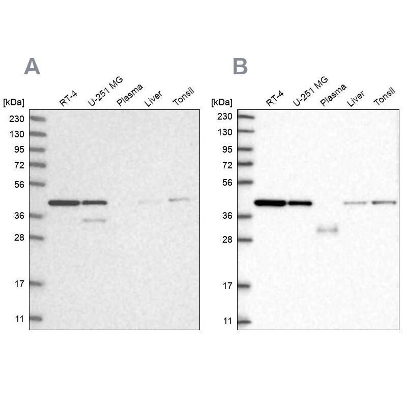 NIPP1 Antibody - BSA Free Western Blot: NIPP1 Antibody - BSA Free [NBP1-90113]