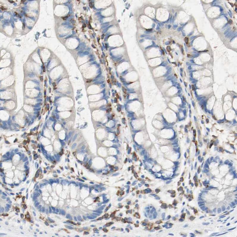 actin-related protein 2/3 complex subunit 1B Antibody - BSA Free Immunohistochemistry: actin-related protein 2/3 complex subunit 1B Antibody - BSA Free [NBP1-90114]