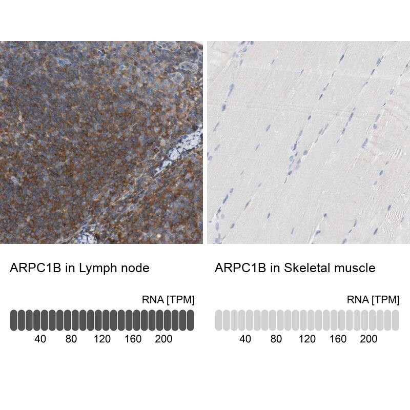 actin-related protein 2/3 complex subunit 1B Antibody - BSA Free Immunohistochemistry: actin-related protein 2/3 complex subunit 1B Antibody - BSA Free [NBP1-90114]