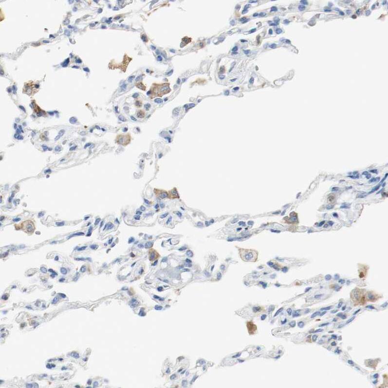 actin-related protein 2/3 complex subunit 1B Antibody - BSA Free Immunohistochemistry: actin-related protein 2/3 complex subunit 1B Antibody - BSA Free [NBP1-90114]