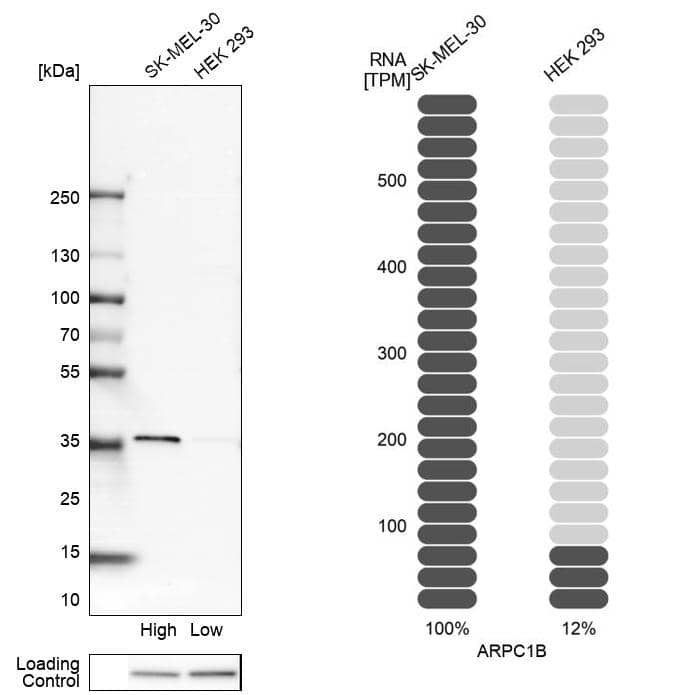 actin-related protein 2/3 complex subunit 1B Antibody - BSA Free Western Blot: actin-related protein 2/3 complex subunit 1B Antibody - BSA Free [NBP1-90114]