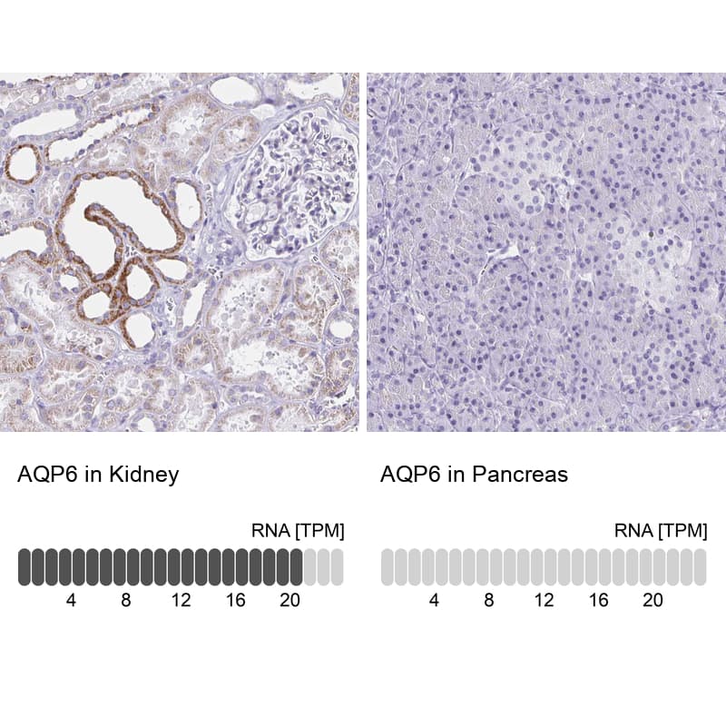 Aquaporin-6 Antibody - BSA Free Immunohistochemistry: Aquaporin-6 Antibody - BSA Free [NBP1-90119]