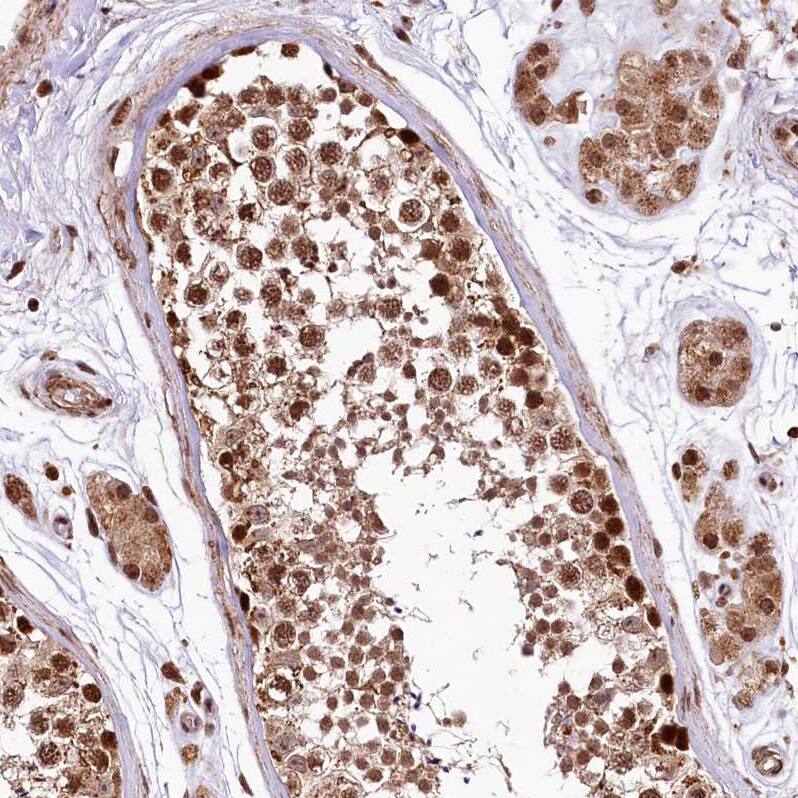 APRIN Antibody - BSA Free Immunohistochemistry: APRIN Antibody - BSA Free [NBP1-90122]