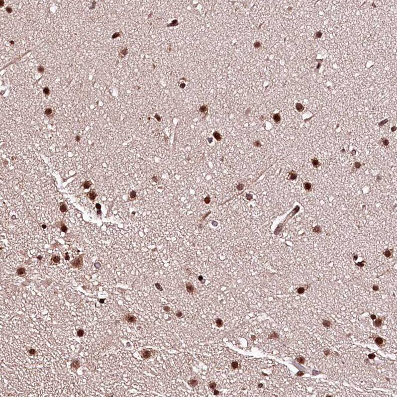 APRIN Antibody - BSA Free Immunohistochemistry: APRIN Antibody - BSA Free [NBP1-90122]