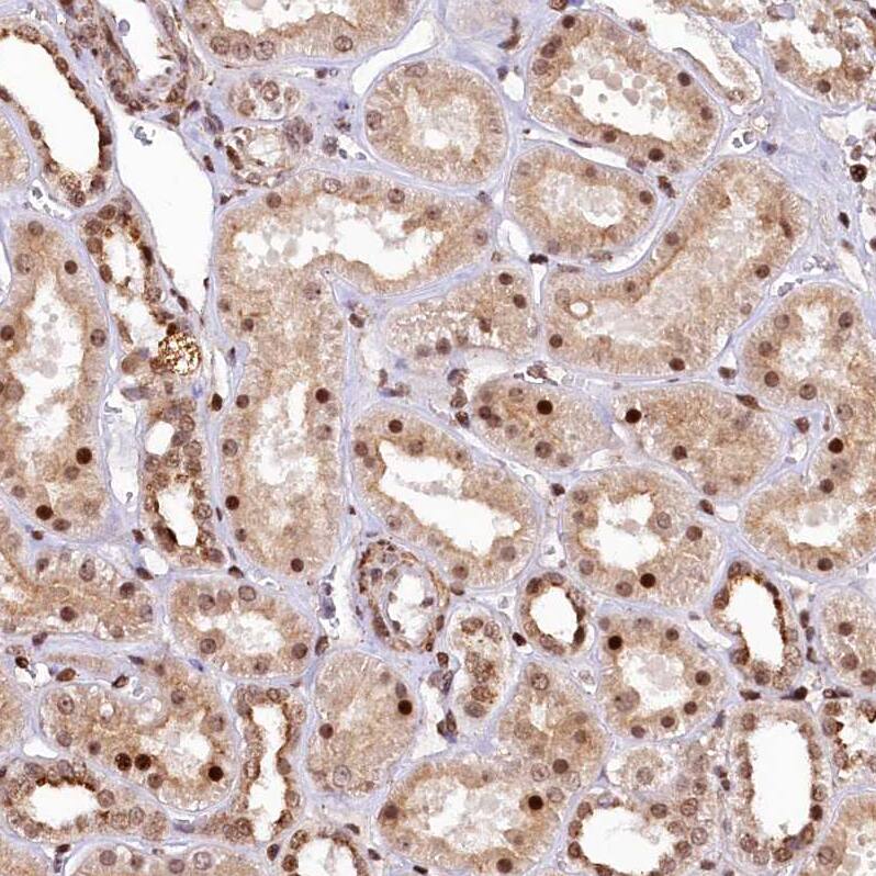 APRIN Antibody - BSA Free Immunohistochemistry: APRIN Antibody - BSA Free [NBP1-90122]
