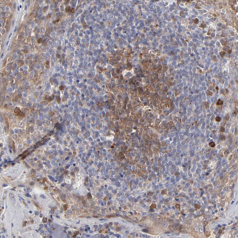 Caspase-3 Antibody - BSA Free Immunohistochemistry: Caspase-3 Antibody - BSA Free [NBP1-90125]