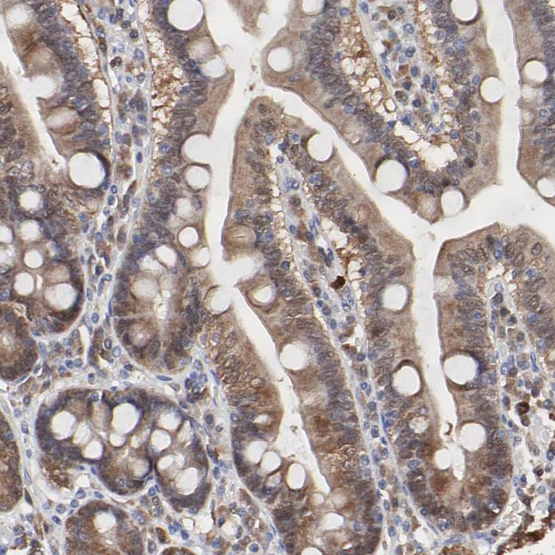 Caspase-3 Antibody - BSA Free Immunohistochemistry: Caspase-3 Antibody - BSA Free [NBP1-90125]