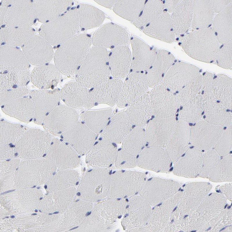 Caspase-3 Antibody - BSA Free Immunohistochemistry: Caspase-3 Antibody - BSA Free [NBP1-90125]