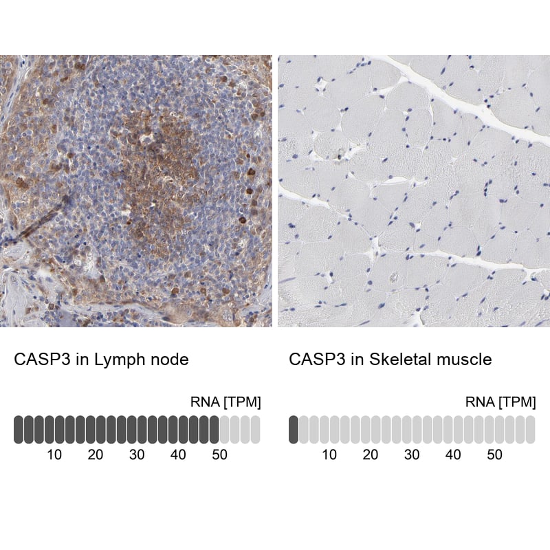 Caspase-3 Antibody - BSA Free Immunohistochemistry: Caspase-3 Antibody - BSA Free [NBP1-90125]