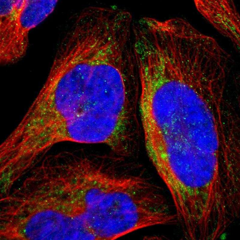 mtRNA polymerase Antibody - BSA Free Immunocytochemistry/ Immunofluorescence: mtRNA polymerase Antibody [NBP1-90126]