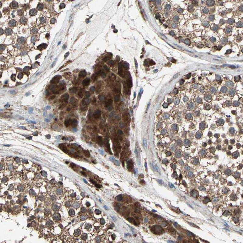 mtRNA polymerase Antibody - BSA Free Immunohistochemistry: mtRNA polymerase Antibody - BSA Free [NBP1-90126]