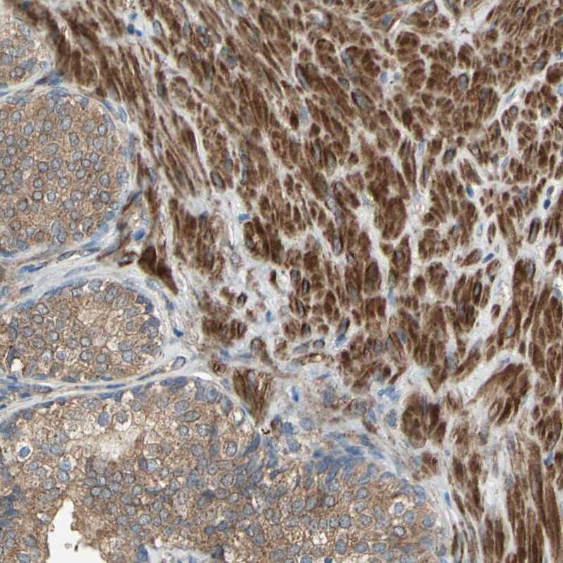 mtRNA polymerase Antibody - BSA Free Immunohistochemistry: mtRNA polymerase Antibody - BSA Free [NBP1-90126]