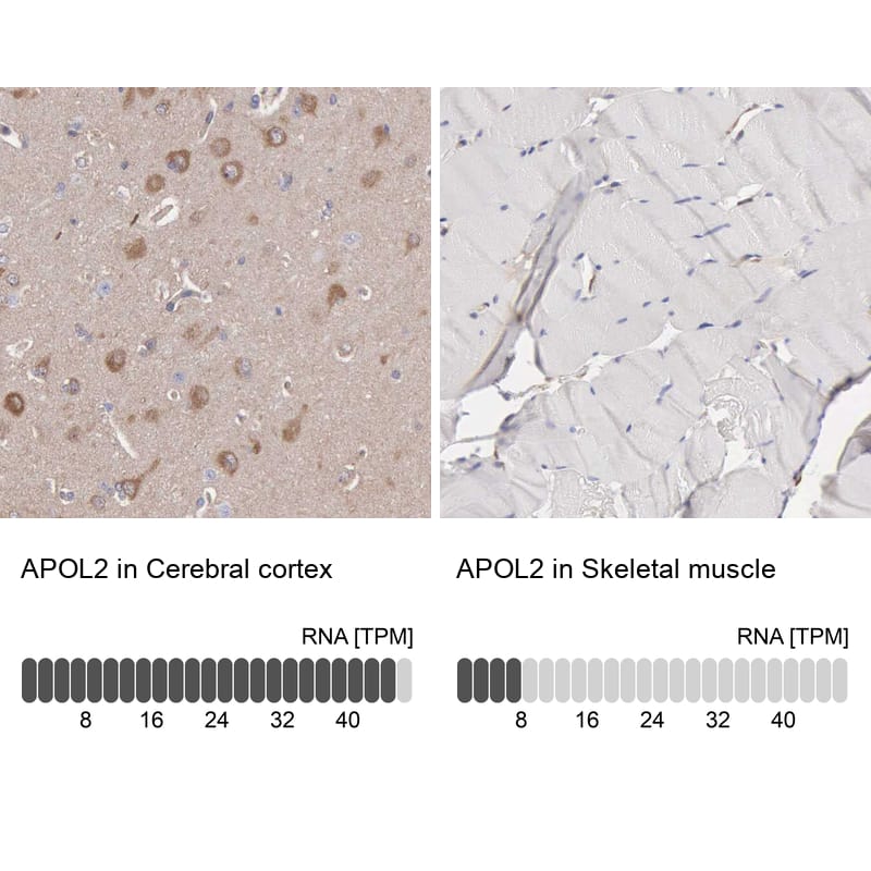 Apolipoprotein L2 Antibody - BSA Free Immunohistochemistry: Apolipoprotein L2 Antibody - BSA Free [NBP1-90127]