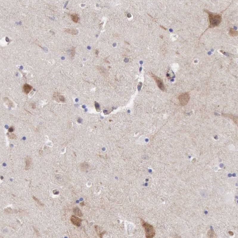 Apolipoprotein L2 Antibody - BSA Free Immunohistochemistry: Apolipoprotein L2 Antibody - BSA Free [NBP1-90127]