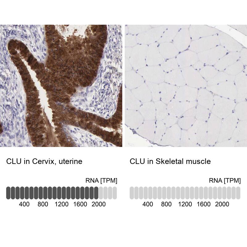 Clusterin/APOJ Antibody - BSA Free Immunohistochemistry: Clusterin/APOJ Antibody - BSA Free [NBP1-90128]