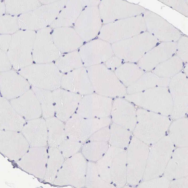 Clusterin/APOJ Antibody - BSA Free Immunohistochemistry: Clusterin/APOJ Antibody - BSA Free [NBP1-90128]