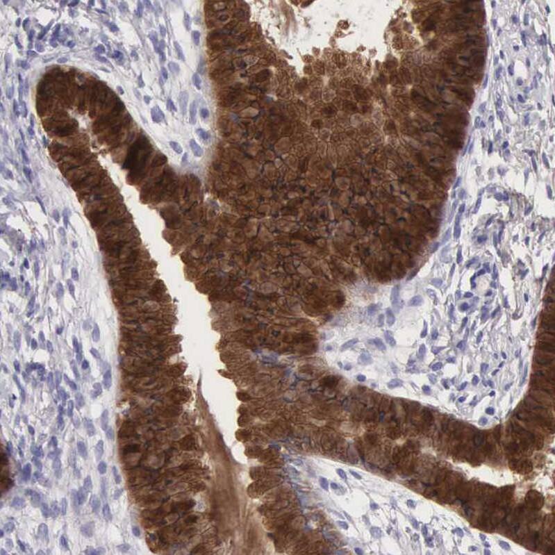Clusterin/APOJ Antibody - BSA Free Immunohistochemistry: Clusterin/APOJ Antibody - BSA Free [NBP1-90128]