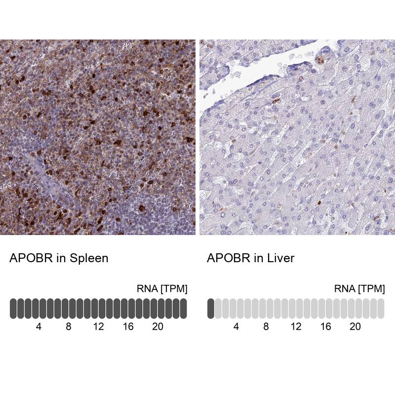 APOB48R Antibody - BSA Free Immunohistochemistry: APOB48R Antibody - BSA Free [NBP1-90129]