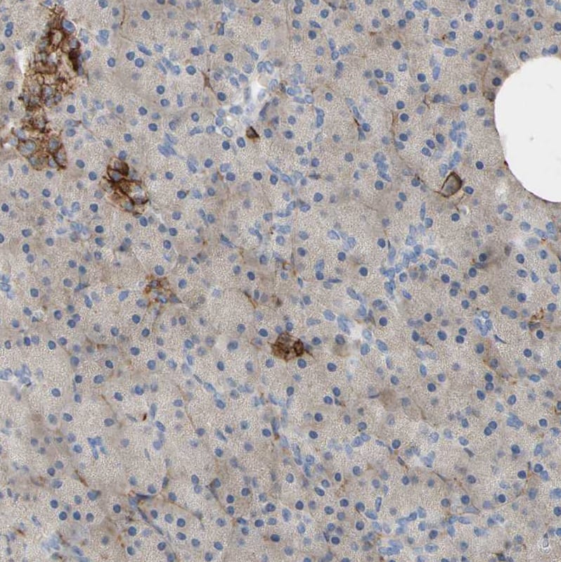 Annexin A6 Antibody - BSA Free Immunohistochemistry: Annexin A6 Antibody - BSA Free [NBP1-90149]